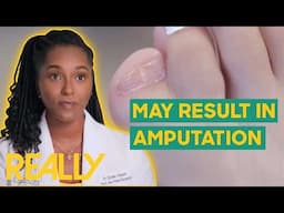 Dr. Ebonie Has To Act Fast During Potentially Dangerous Toe Surgery | My Feet Are Killing Me