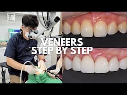Korean Veneers Step-by-Step | Full Procedure, Before & After + What to Expect in Korea