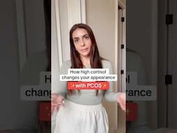 How high cortisol can change your appearance with #pcos