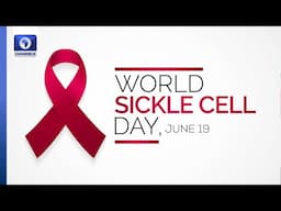 Sickle Cell Foundation Seeks Improved, Transforming Care