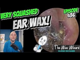 VERY SQUASHED EAR WAX! (Buddy's back!) Episode 436