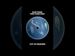 Blue Vision Post Operation Short