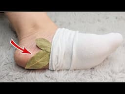 I would die and not know! Put a bay leaf on your feet and don't spend money at the market