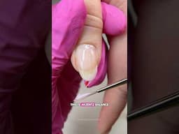 Nail Correction with Hard Gel 🙌🏻