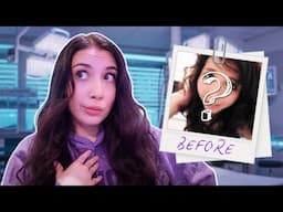Coming Clean About My Secret Plastic Surgery
