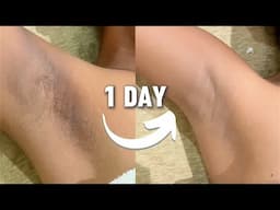 Underarms Whitening | Step by Step Process | HINDI