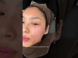 Come with me to Korea for the ultimate skin glow-up! 🫶🏼 #thaonhile