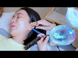 ASMR Visual Ear Cleaning & Blackhead Removal (So Satisfying & Real Sounds)