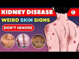 10 Shocking Skin Signs of Kidney Disease You Need to Know