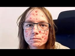 The TikToker Who Refuses To Shower