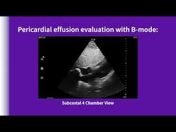 Vscan Air™ | Using presets for evaluations: pericardial effusion