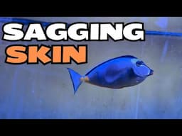 Naso Tang Has Sagging Skin