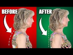 Fast Way to Get Rid of Neck Hump - 4 Easy Exercises!