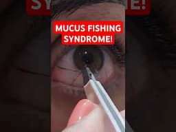 What Is Mucus Fishing Syndrome? How To Stop It!