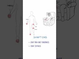 Osteoarthritis EXPLAINED #jointpain #arthritis #healthsketch
