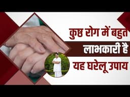 कुष्ठ रोग (Leprosy) में बहुत लाभकारी है यह घरेलू उपाय || Acharya Balkrishna