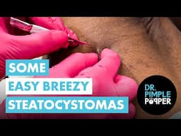 Some Easy Breezy Steatocystomas