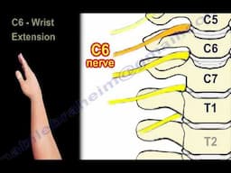 Cervical Spine Myelopathy & Radiculopathy