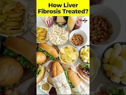 What Doctors Don't Tell You About Liver Fibrosis Treatment