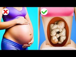 Rich Vs Broke Pregnant - Squid Game Doll Vs Barbie || Smart Pregnancy Gadgets