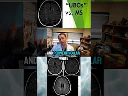 MS MRI Lesions vs. "benign" White Matter Lesions