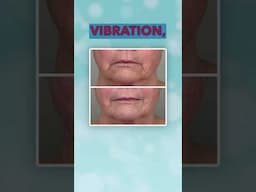 Hybrid Lift Pro: A Powerful EMS/Microcurrent Device for Facial Rejuvenation