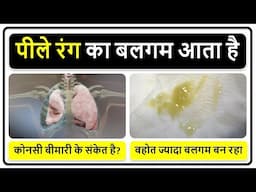 पीले रंग का बलगम आता है