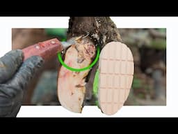 her foot was DECAYING from the INSIDE OUT