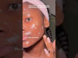 The one product that actually transformed my skin #skincare #tretinoin #tretinoinjourney