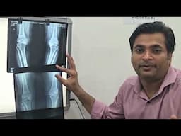 पाश्चात्य चिकित्सा की केवल दवाईया लेने से मरीज को क्या-क्या समस्याएं आयी | Dr. Manish Yadav | Kanpur