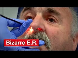 Man Swallows His Dentures - Bizarre ER
