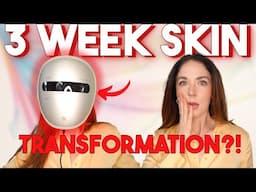 I Tried This Viral $250 LED Mask for 3 Weeks—Here’s the Truth 😳