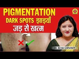 Acupressure Points For Hyperpigmentation