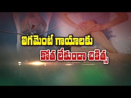 లిగమెంట్ గాయాలకు కోతలేకుండా చికిత్స| About Arthroscopic Ligament Reconstruction|Sukhibhava | ETVLife