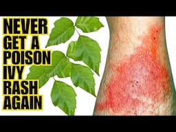 How To Never Get A SEVERE POISON IVY RASH | Q4 Method