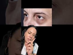 HOW TO COVER DARK UNDEREYES! #makeuptutorial #makeuptips #darkcircles #concealer