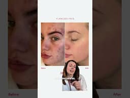 I thought my team had made a MISTAKE... #skinbarrierrepair #clearskintips