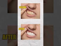How to whiten teeth in photoshop #photoshoptutorial