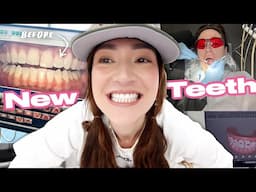 Finally Showing You My New Teeth!!!