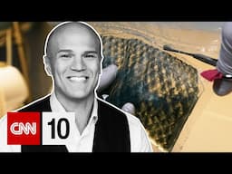 How fish skin saved this child’s life | June 6, 2025