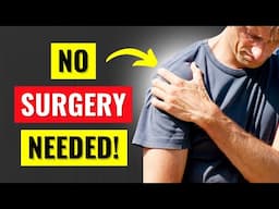 How to Heal a Rotator Cuff Tear Without Surgery (2025)