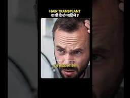 ✅ Hair Transplant कधी केलं पाहिजे ? #marathipodcast #shrimantstudio #shortvideo