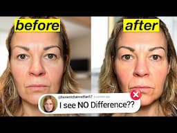 I Tried A Non-Surgical EYELIFT And It FAILED! Here’s Why and What’s Next