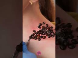 What's that ​​on her shoulder?😱 Let's save this girl ASAP #fakebody