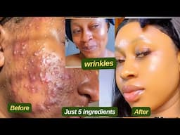 Erase All wrinkles and Stubborn Dark spots in 3 days