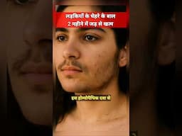 Homeopathic medicine for unwanted facial hair #homeopathy #unwantedhair #modernhomeopathy
