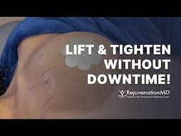 Get a Beautiful Breast Lift WITHOUT Surgery or Downtime!