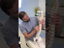 HUGE Disc Injury Causes Nervy Weakness! #shorts #chiropractor
