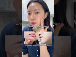 K-Beauty Secret Drink for Clear Skin?!