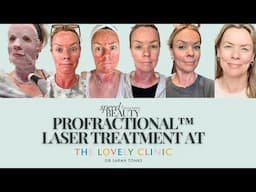 Vlog of my skin re-surfacing ProFractional™ Laser treatment - all you need to know.